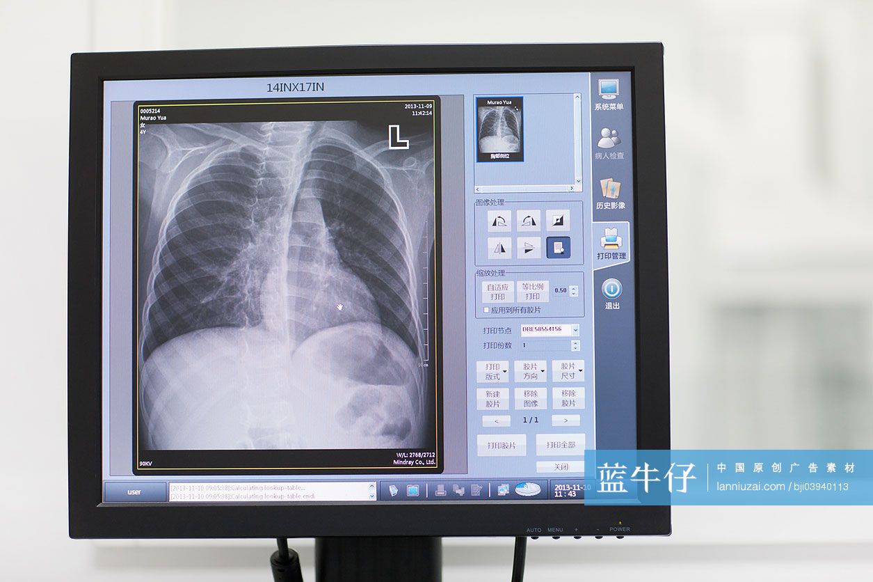 医院电脑屏幕