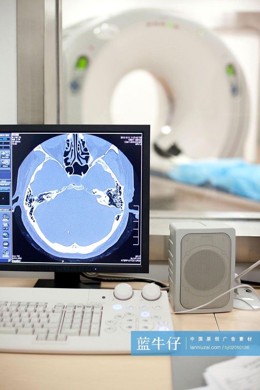 医院CT扫描