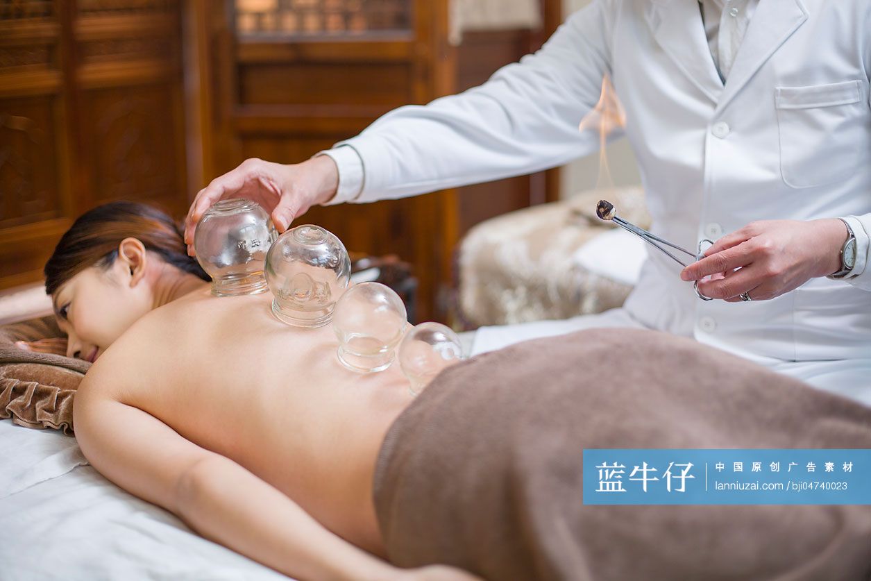 年轻女子接受中医拔罐治疗