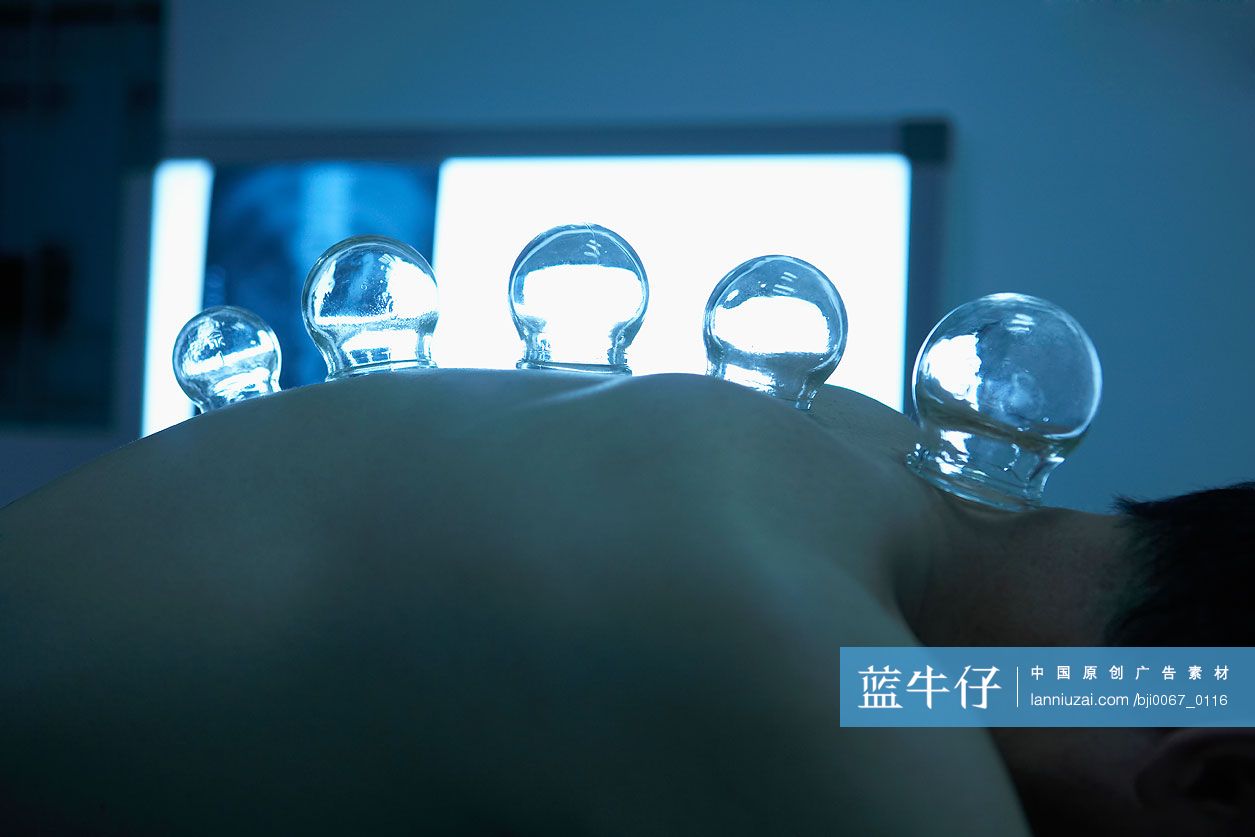 拔罐