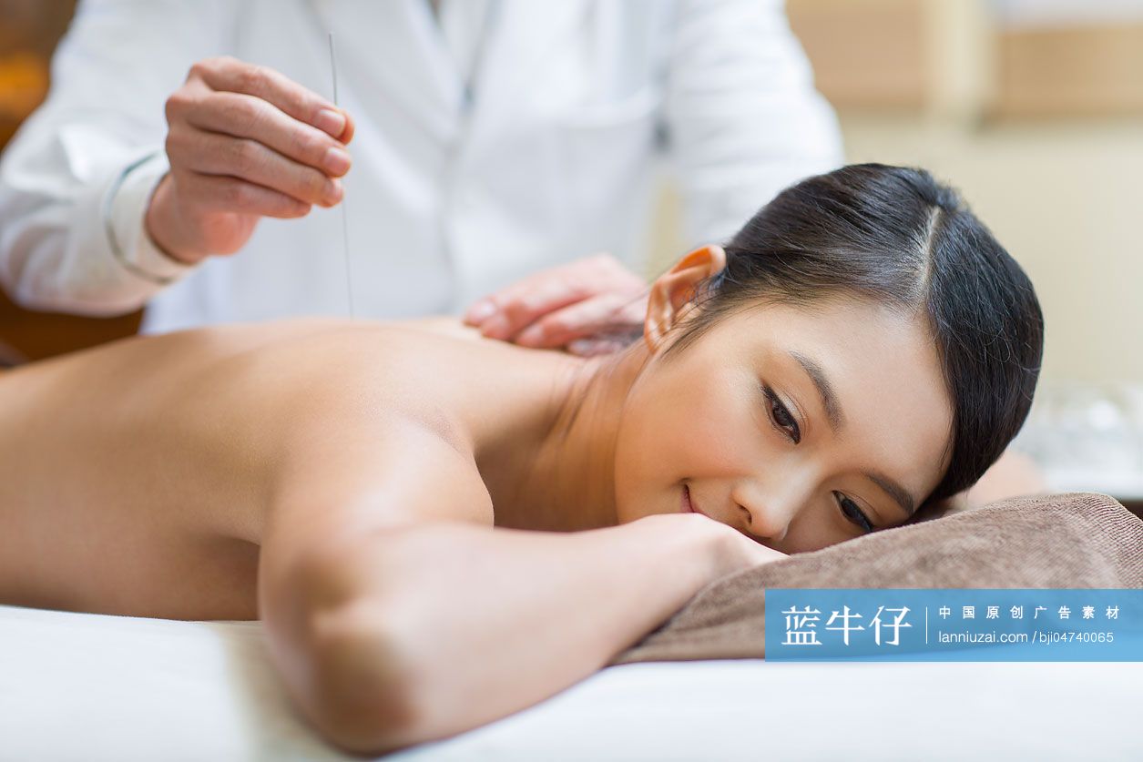 年轻女子接受针灸治疗
