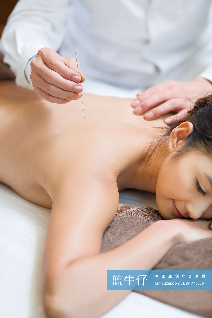 年轻女子接受针灸治疗