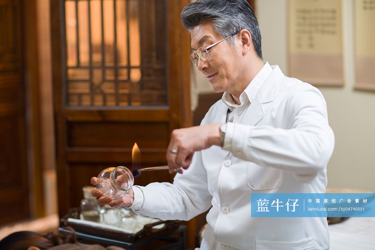 老中医做拔罐治疗