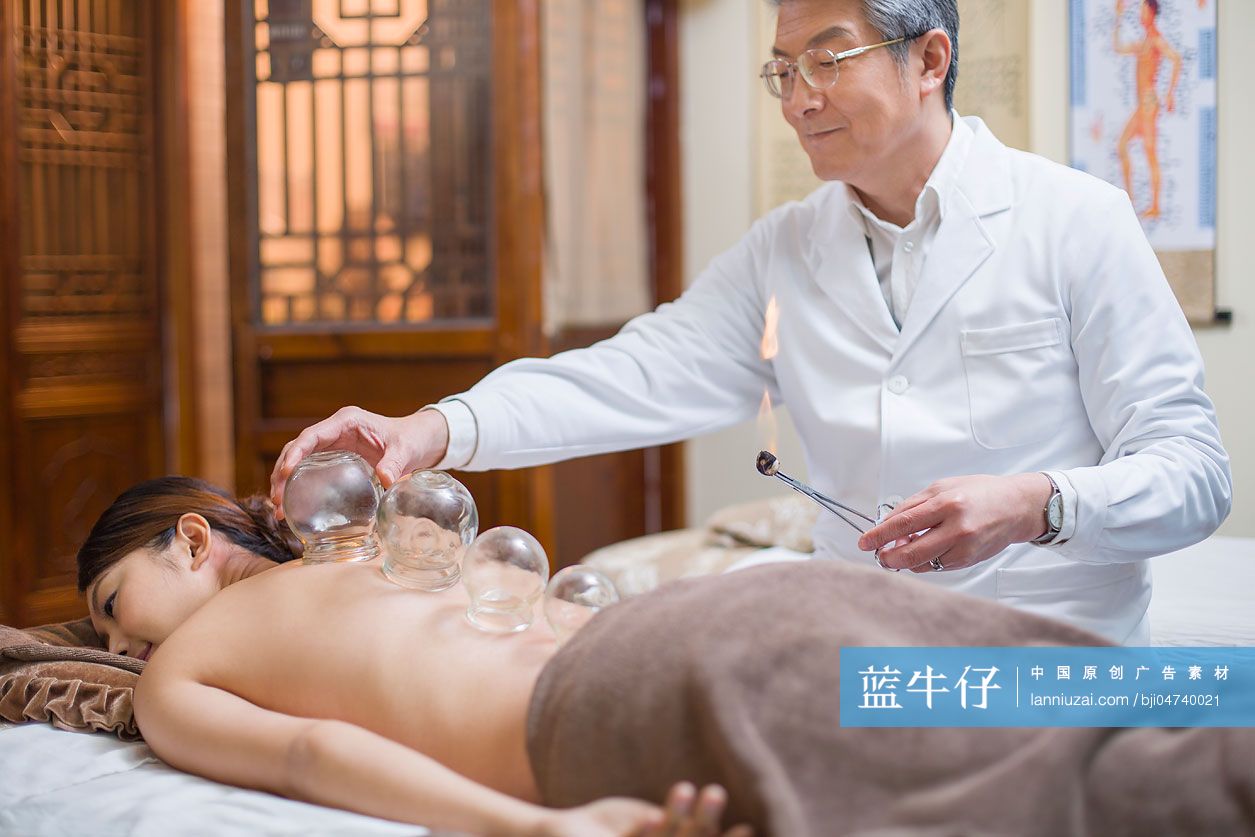 年轻女子接受中医拔罐治疗